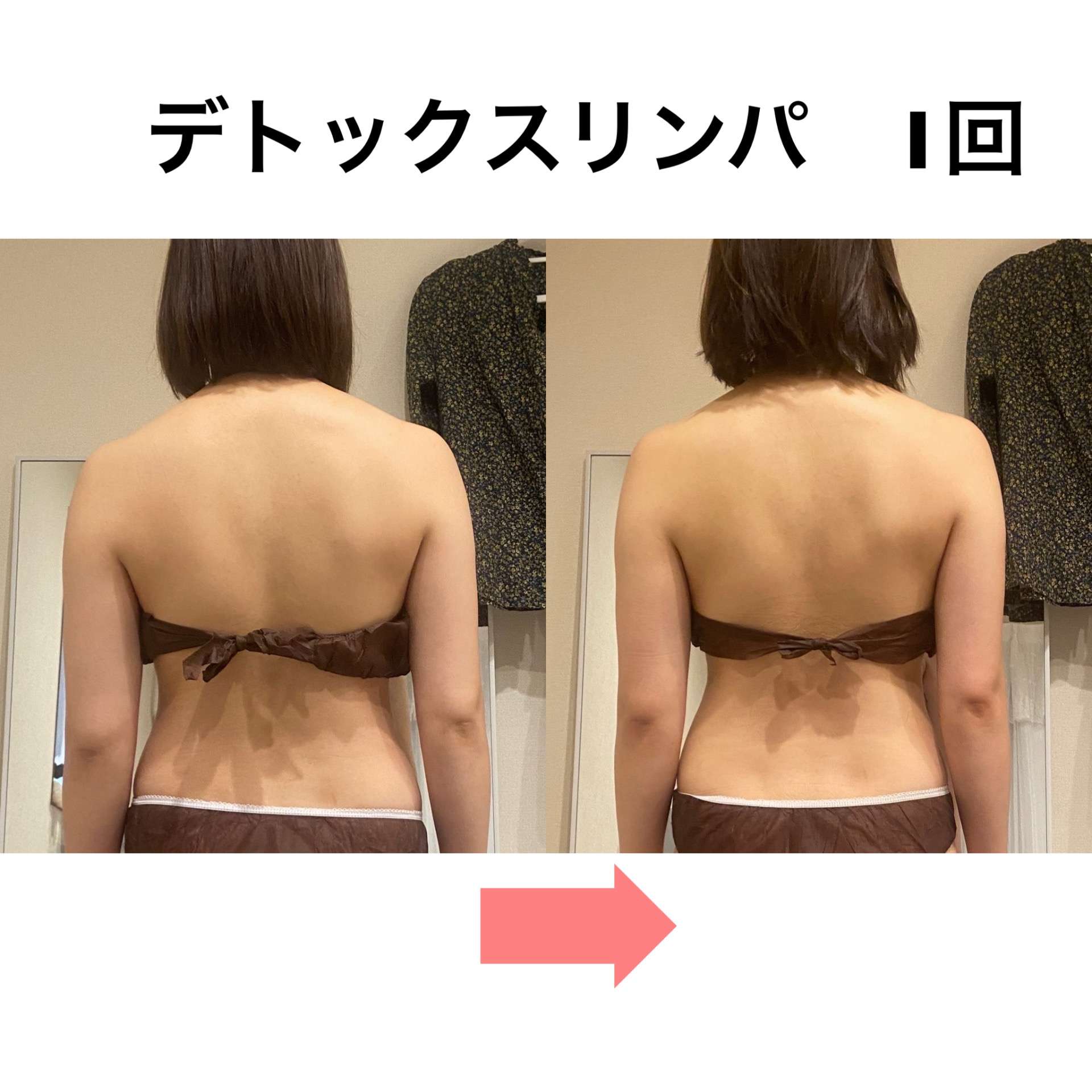 手から電気（微弱電流）を流すエステって！？ | BLOG | 名東区のエステ