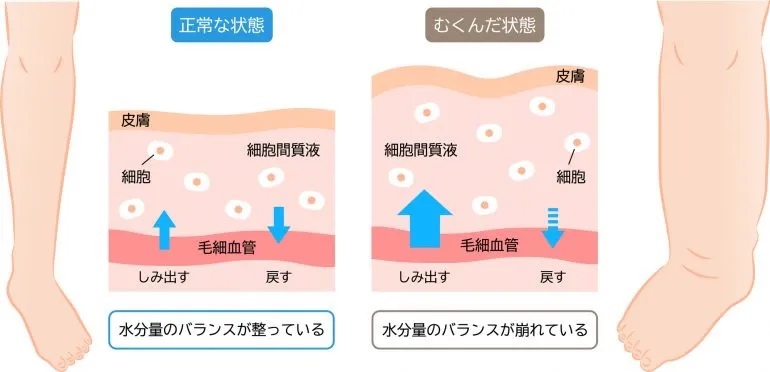 お正月太りしてしまった方へ