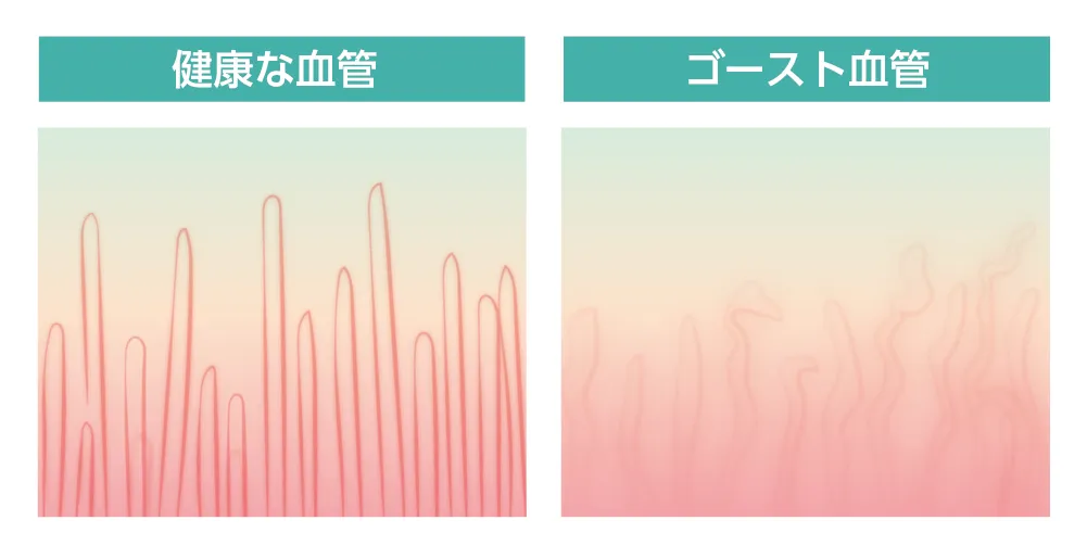 毛細血管の劣化を防いで若返り