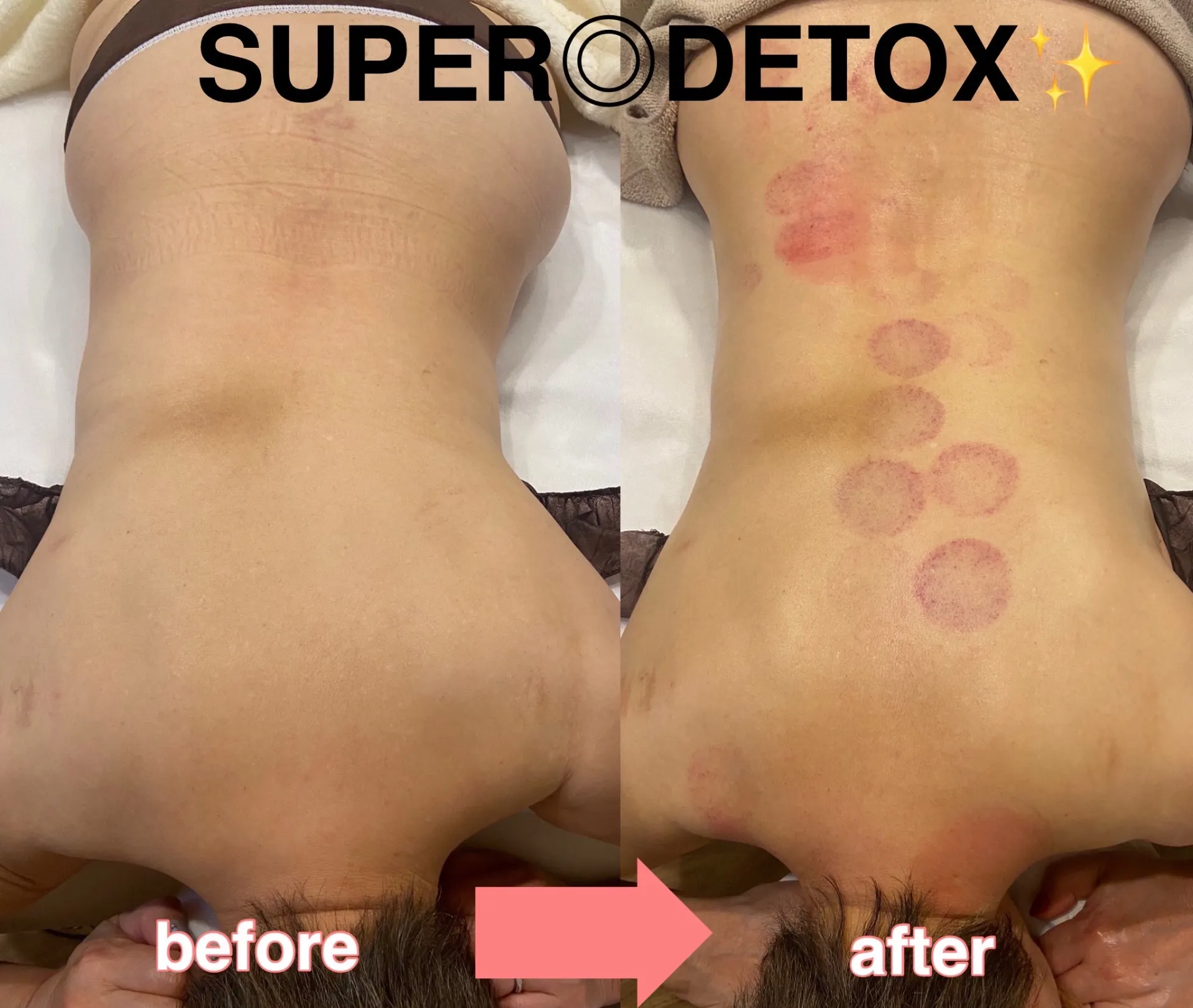 スーパーデトックスってどんなお手入れ？