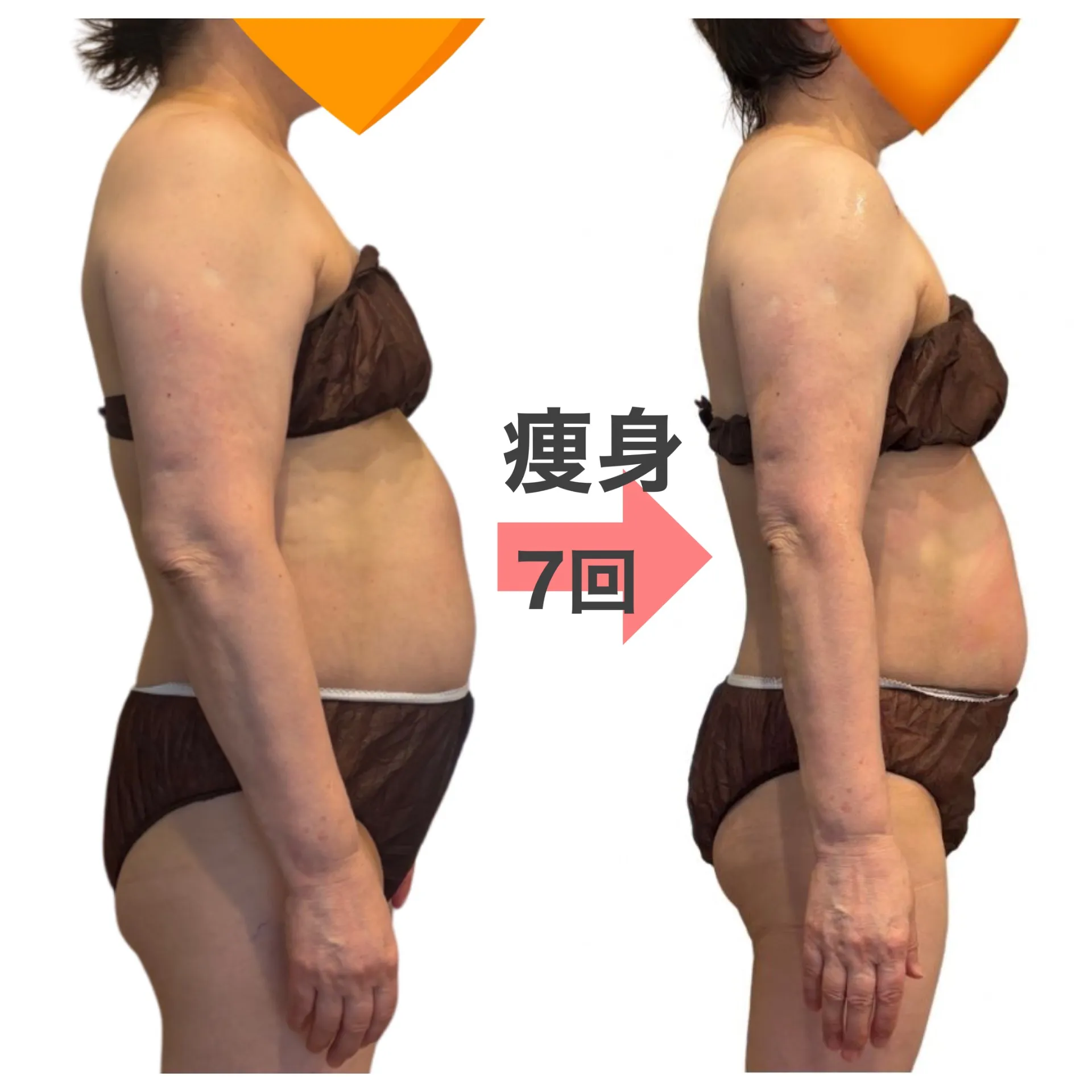 年内に絶対痩せたいあなたへ